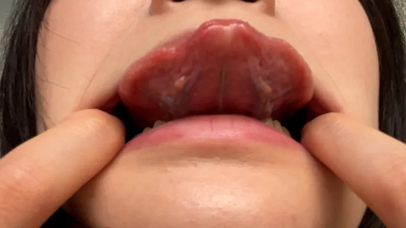 【天乃のあ】街角口内01