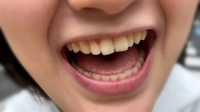 【天乃のあ】街角口内01