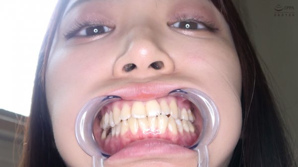 激カワ人気女優 加賀美さら チャンの激レアマウスオープナー着用して口内・歯観察＆電マ当て！