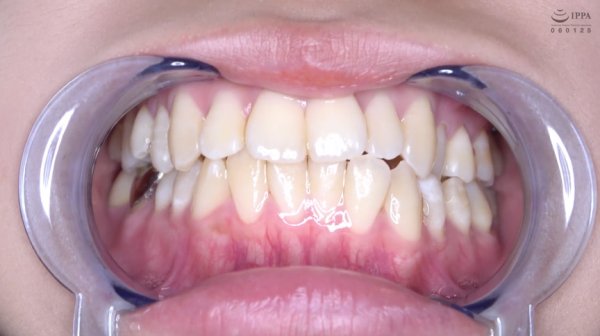 激カワ人気女優 加賀美さら チャンの激レアマウスオープナー着用して口内・歯観察＆電マ当て！