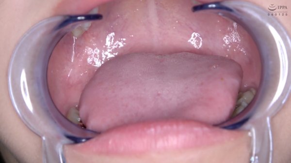 激カワ人気女優 加賀美さら チャンの激レアマウスオープナー着用して口内・歯観察＆電マ当て！