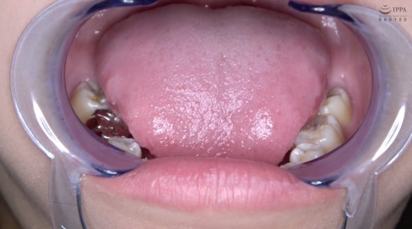 激カワ人気女優 加賀美さら チャンの激レアマウスオープナー着用して口内・歯観察＆電マ当て！