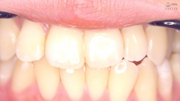 激カワ人気女優 加賀美さら チャンの激レアマウスオープナー着用して口内・歯観察＆電マ当て！