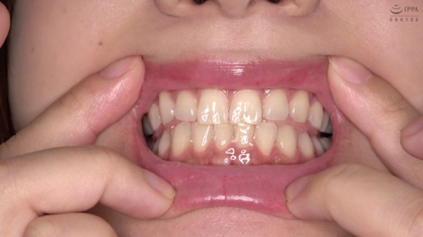 【歯・口内】激カワ女優 あべみかこチャンの舌ベロ・歯・口内・のどちんこ観察★